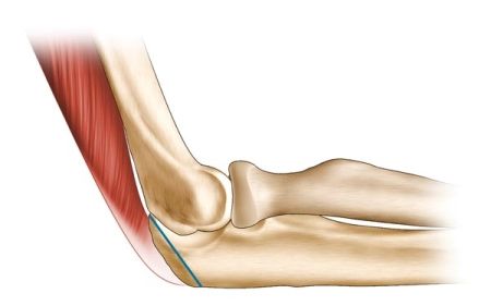 Une nouvelle voie d'abord du coude : L'olécranotomie digastrique