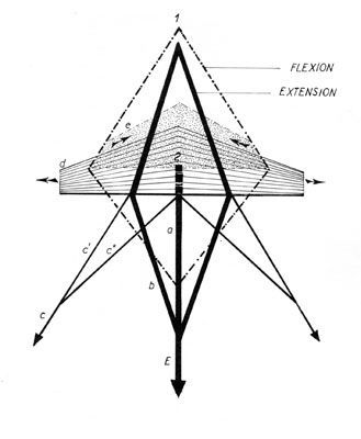 Le doigt en maillet traumatique (mallet finger)