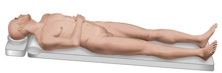 Résection de la première côte par voie sus et sous claviculaire dans le traitement du syndrome du défilé thoraco-cervico-brachial