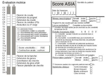 Comment raisonnons-nous en 2009 devant une fracture du rachis thoraco-lombaire et lombaire ?