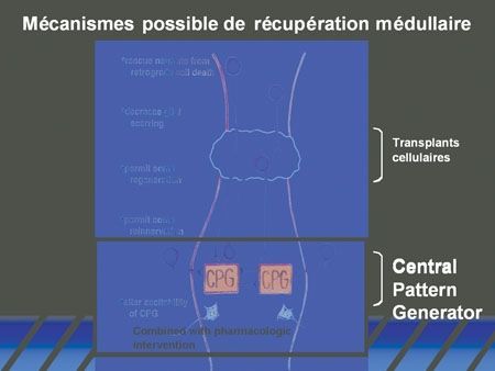 Etat de la recherche concernant les traumatismes vertébro-médullaires