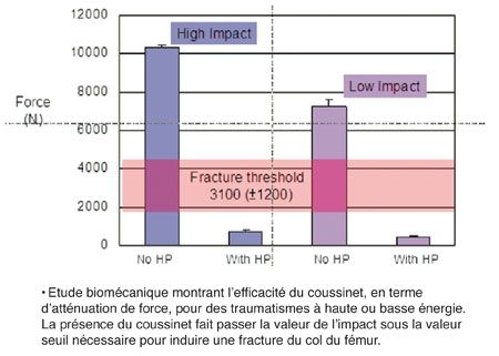 Etude biomécanique d'un protecteur de hanche adapté aux données anthropométriques de la femme chinoise âgée
