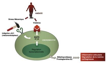 Le déclin de l'empire prothétique ?