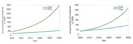 Chirurgie prothétique conservatrice du genou