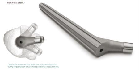 Le pivot Wagner Cone : un implant "niche" peu connu... - Etude clinique et radiologique de 74 pivots Wagner Cone