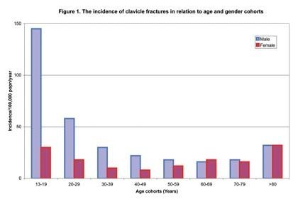 GECO formation : Les fractures de la clavicule