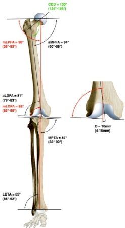 Analyse et planification des déformations adjacentes au genou