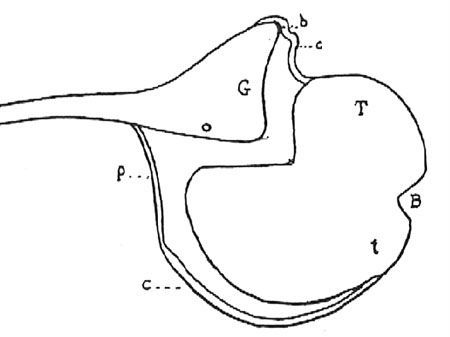 Technique de stabilisation arthroscopique Hill-Sachs