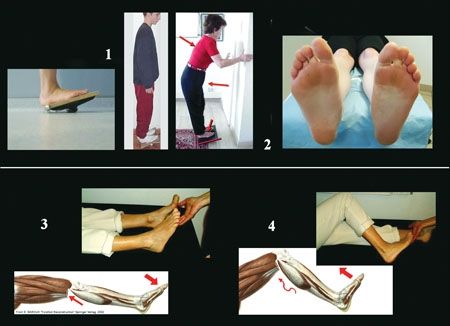 Brièveté des gastrocnémiens : compte-rendu du symposium. Congrès SFMCP - AFCP Toulouse juin 2006