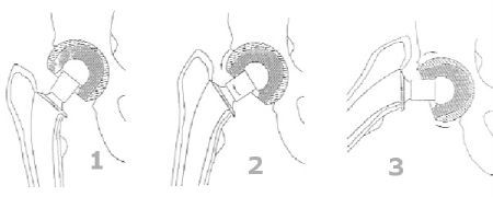 Paul Dautry chirurgien