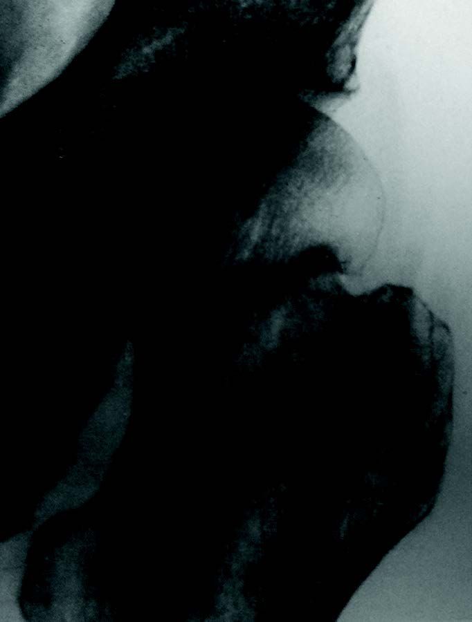 Connaissez-vous la classification de Garden ?