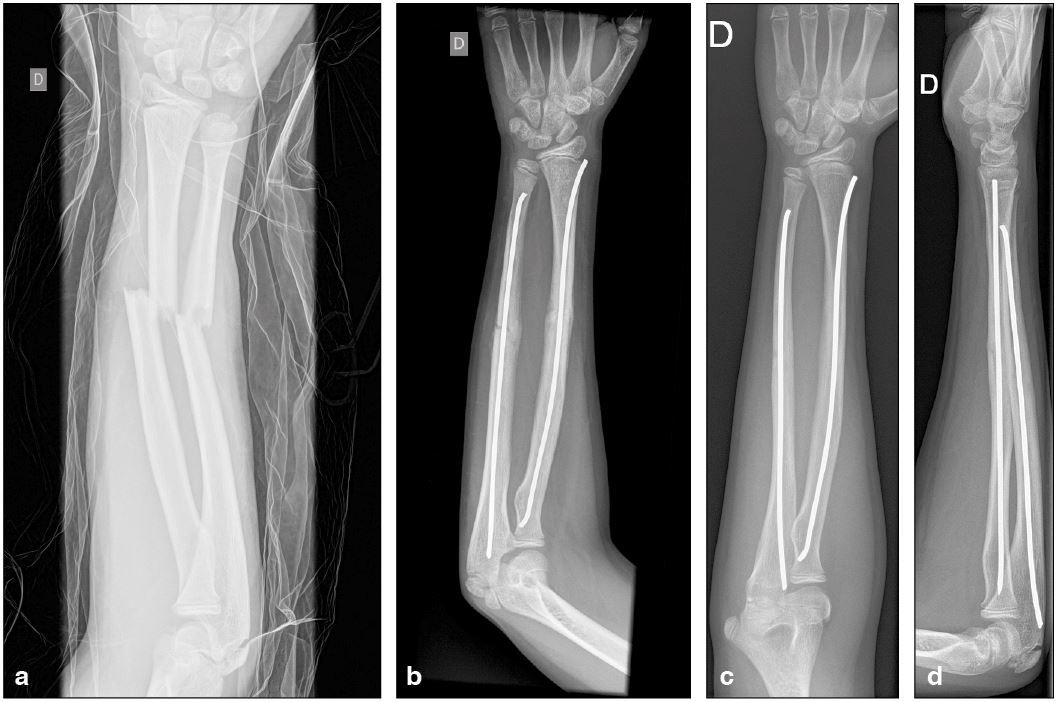 ECMES : Master technique en 10 points
