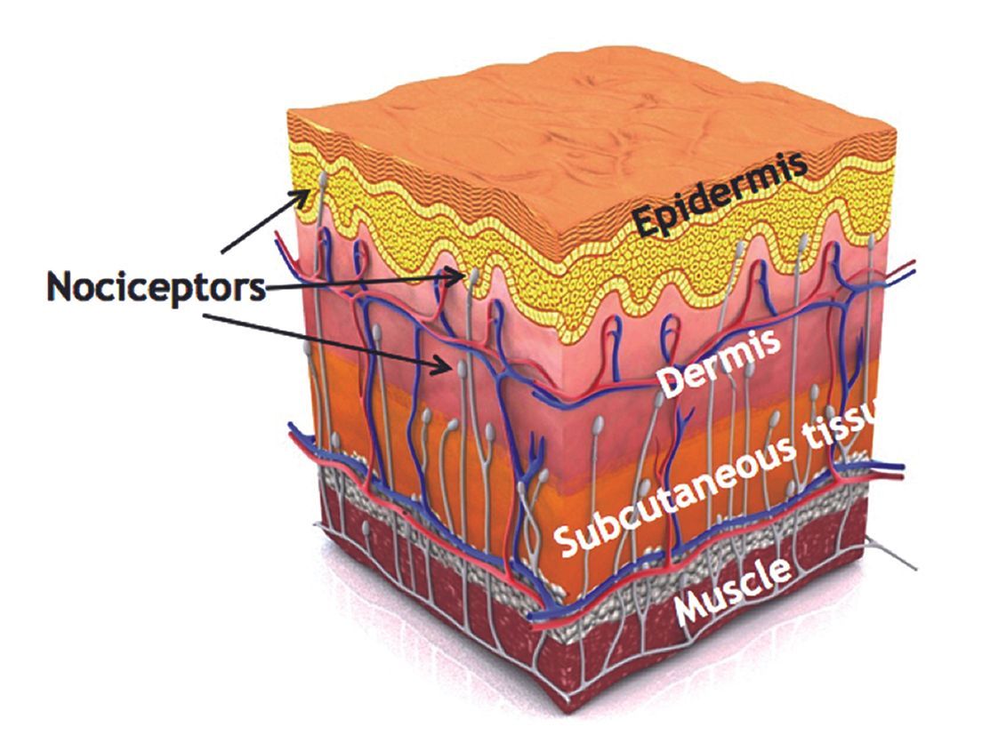 Les injections périarticulaires dans les arthroplasties totales du genou : Guide technique
