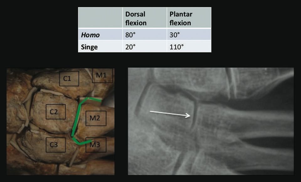 Étude biomécanique de la plaque plantaire