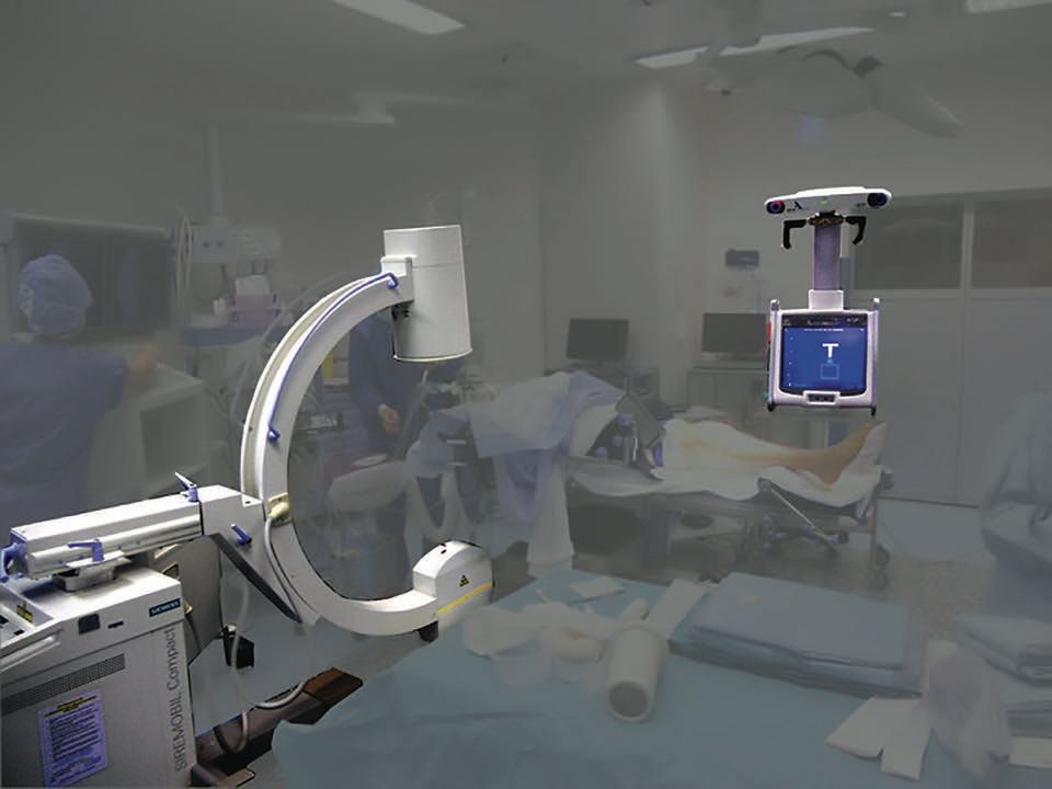 Prothèse totale du genou et ostéotomie combinée :  Aspects techniques et intérêt de la navigation