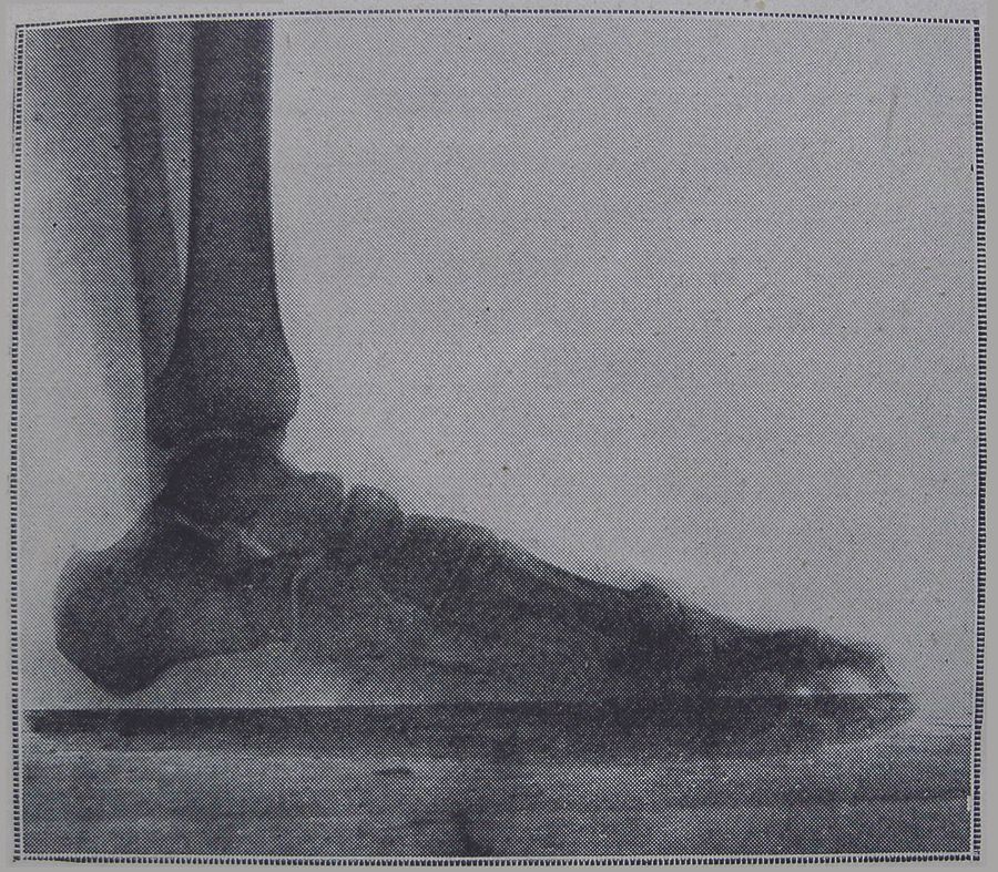 L’illustration : Journal Universel - N°3906, 76ème année 12 Janvier 1918