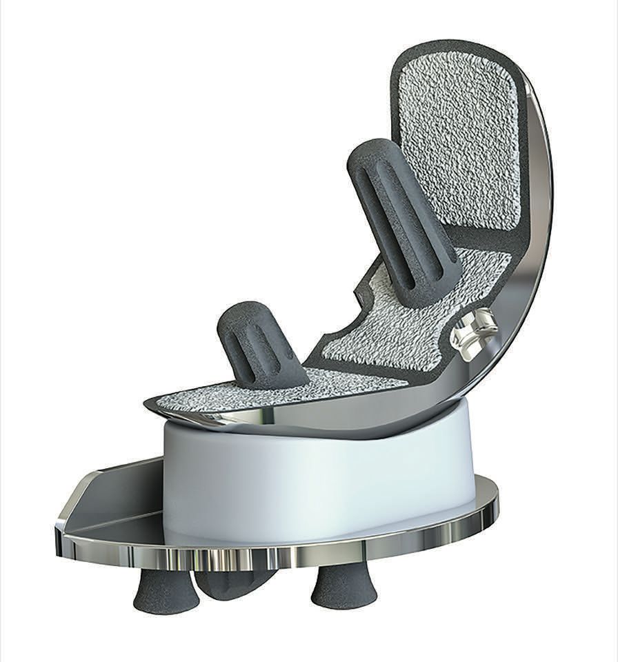 Prothèse unicompartimentale à plateau mobile