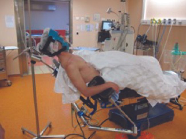 Arthro-latarjet : Conseils aux débutants