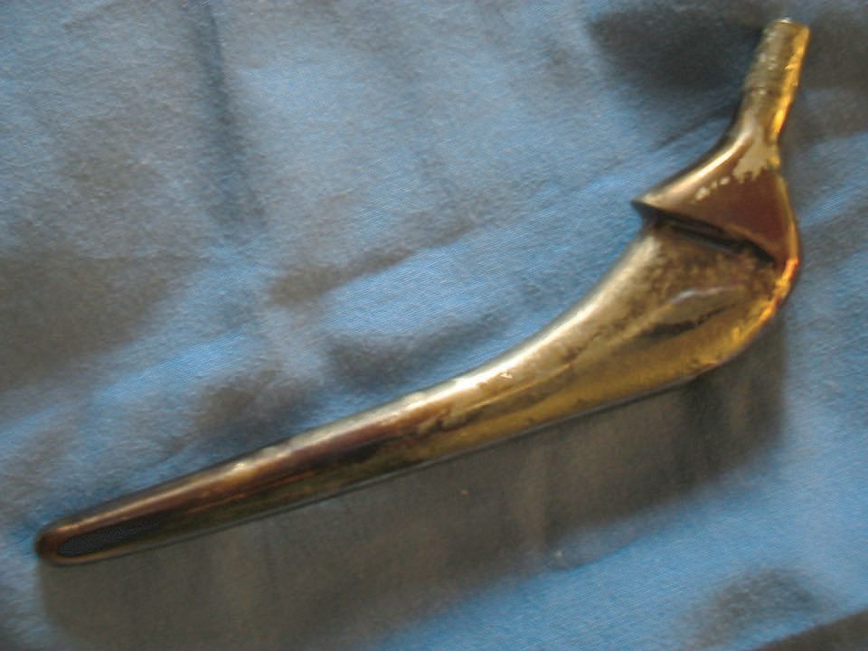 Traitement en 2 temps des prothèses de hanche infectées avec l’utilisation d’un spacer pré-moulé et armé