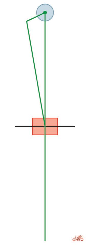 Réaliser une arthroplastie totale de genou est un compromis