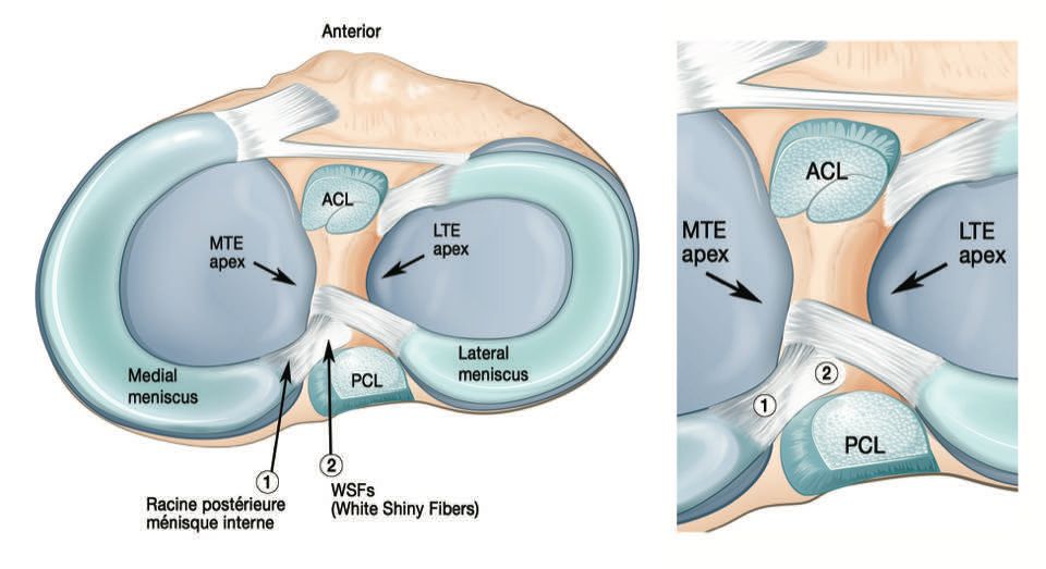 Les lésions de la racine postérieure du ménisque interne