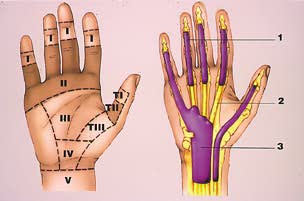 Comment améliorer la chirurgie des tendons de la main