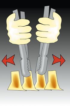 Cages intersomatiques lombaires implantées par voie postérieure : état actuel