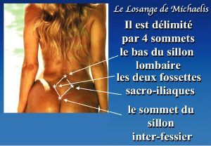 Qui connait le losange de Michaelis ?