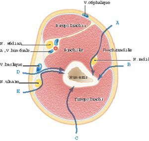 Les différentes voies d'abord pour l'ostéosynthèse par plaques des deux tiers de l'humérus