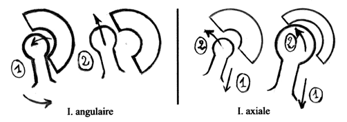La médialisation du centre de rotation. Concept essentiel de la cupule tregor