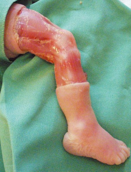 Anatomie du genou pour le chirurgien orthopédiste