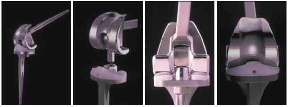 Prothèses de genou à pivot rotatoire Axel 2 : Caractéristiques, technique opératoire standard