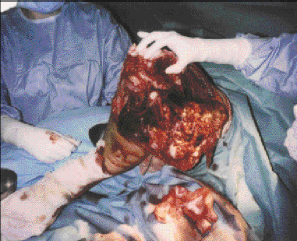 Le parage et la magie