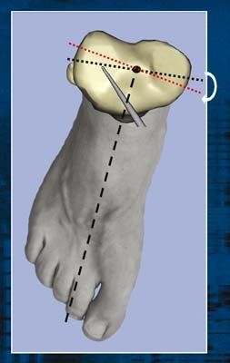 Intérêt de la navigation dans la mise en place d'une PTG