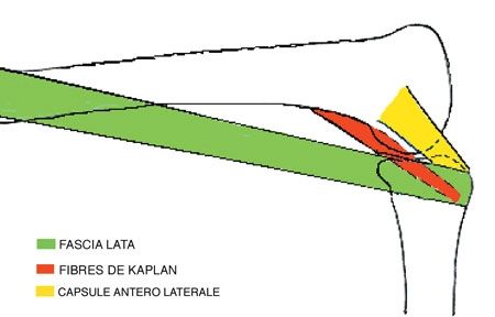 Contrôle de la stabilité rotatoire et ligamentoplastie du LCA