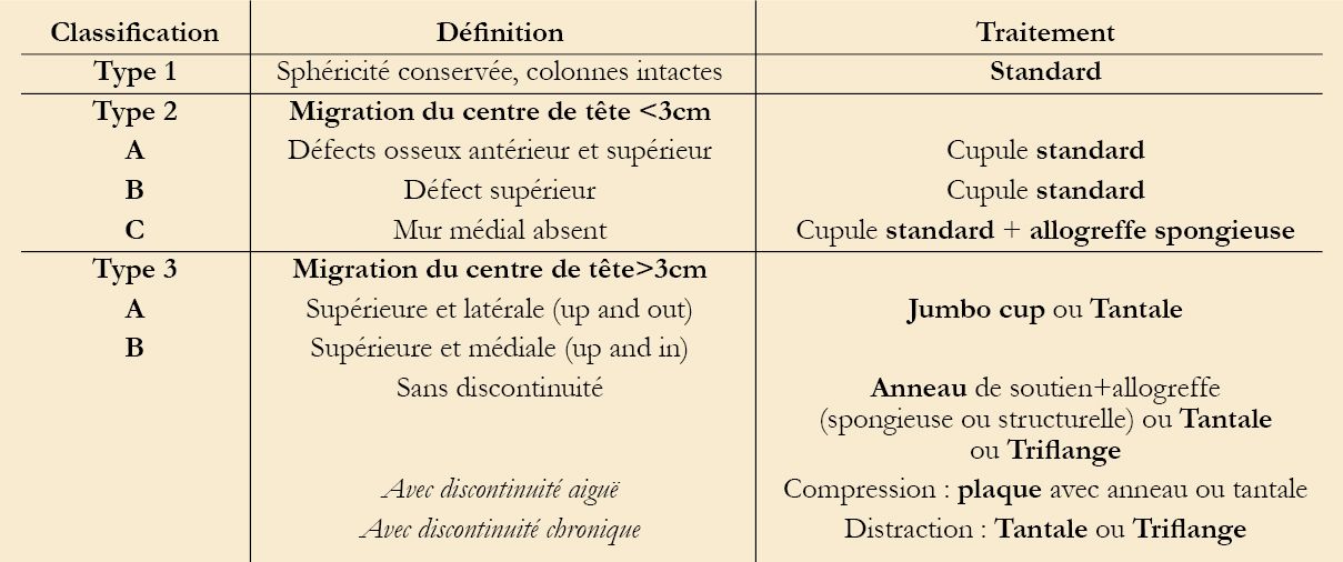 Philosophie des reprises de prothèses totales de hanche à la Mayo Clinic