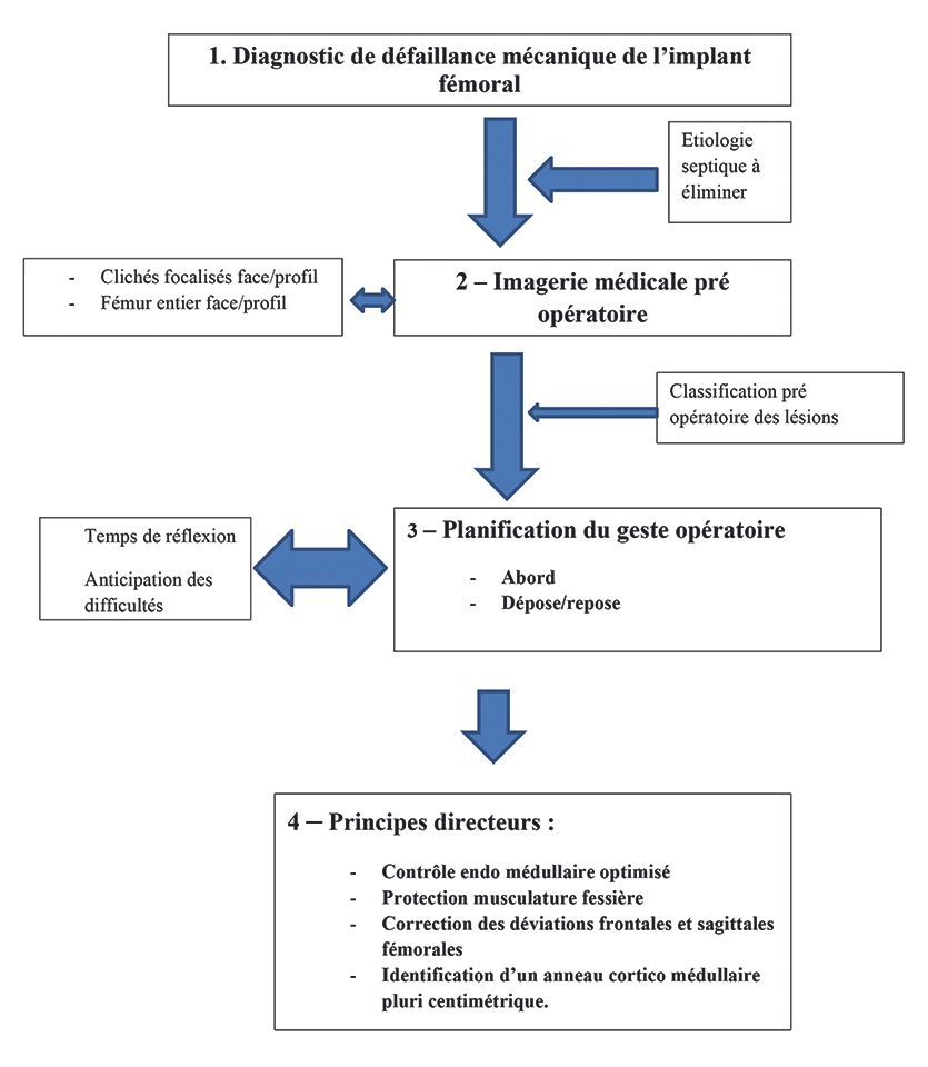 Reprise d’une tige fémorale mécaniquement défaillante : planification et stratégie opératoire