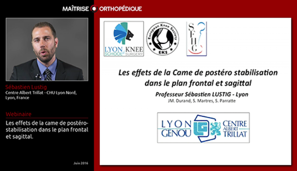 Les effets de la came de postéro-stabilisation dans le plan frontal et sagittal