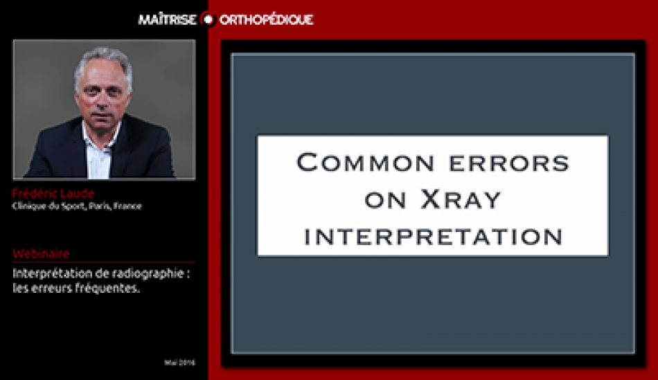 Interprétation de radiographie : les erreurs fréquentes