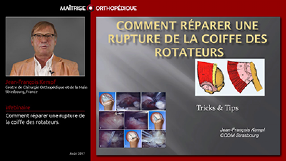 Comment réparer une rupture de la coiffe des rotateurs.
