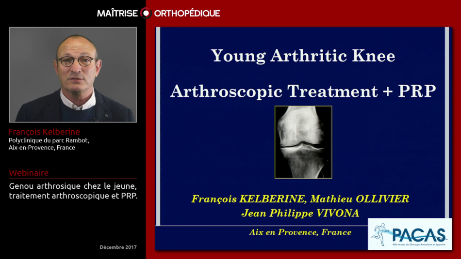 Genou arthrosique chez le jeune. Traitement arthroscopique et PRP.