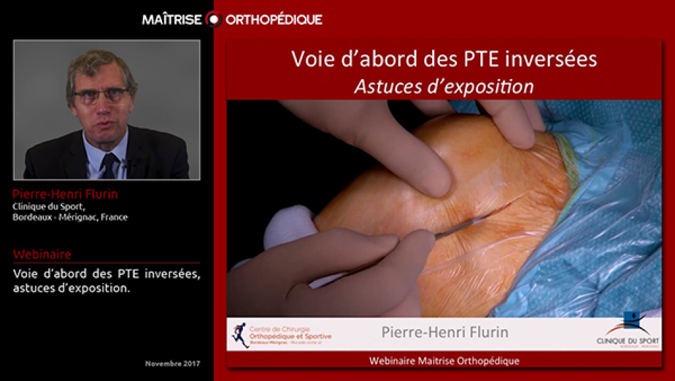 Voie d'abord des PTE inversées : astuces d'exposition.