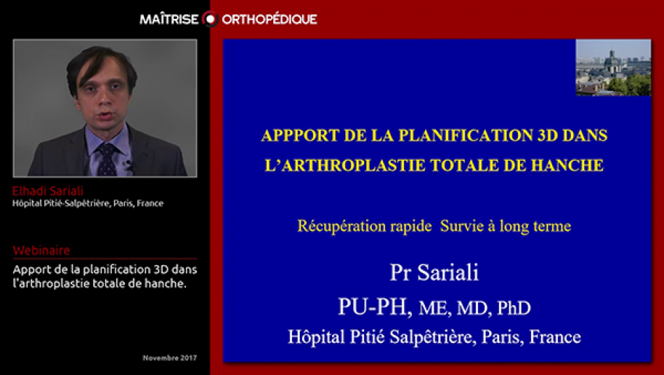 Apport de la planification 3D dans l'arthroplastie totale de hanche.