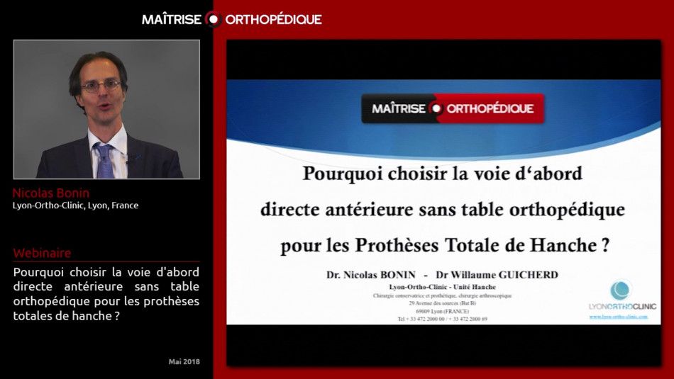 Pourquoi choisir la voie d'abord directe antérieure sans table orthopédique pour les prothèses totales de hanche ?