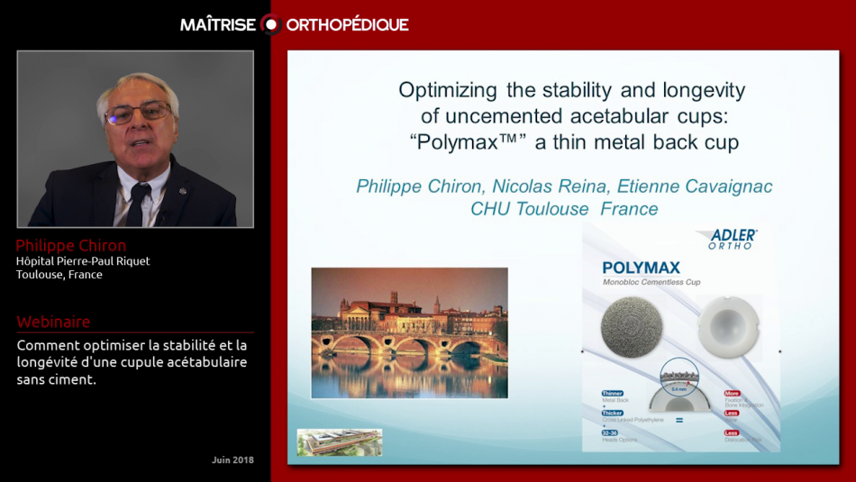 Comment optimiser la stabilité et la longévité d'une cupule acétabulaire sans ciment.