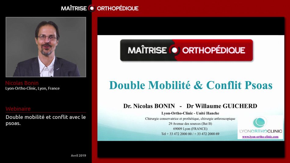 Double mobilité et conflit avec le psoas.