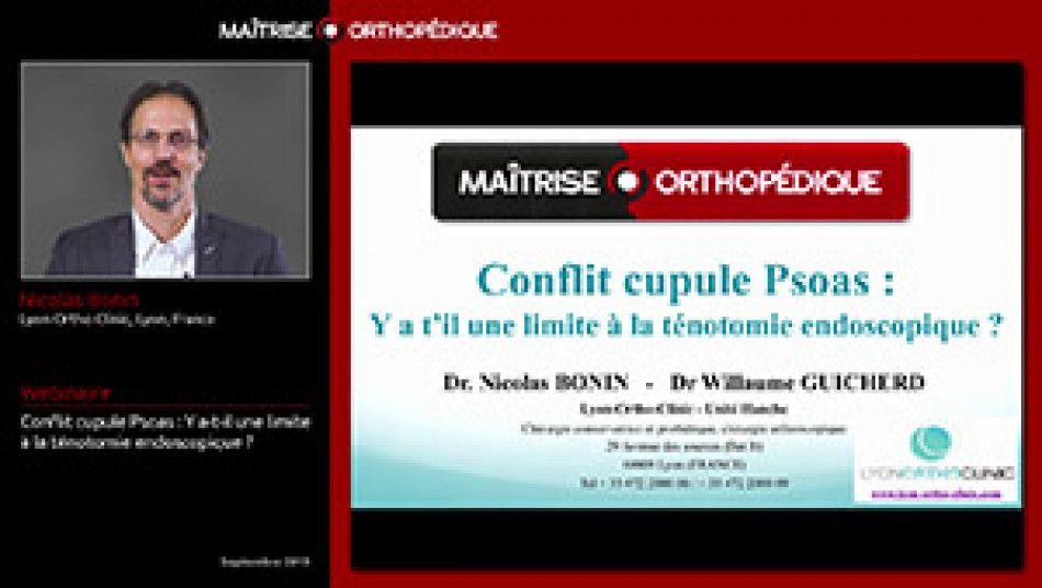 Conflit cupule-psoas : y a-t-il une limite à la ténotomie endoscopique ?