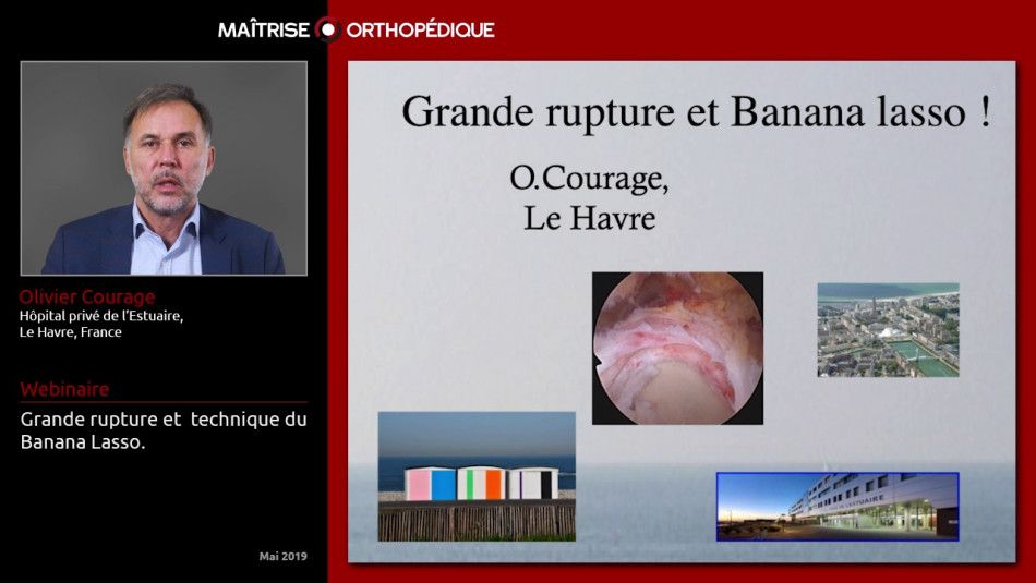 Grande rupture et technique du Banana Lasso