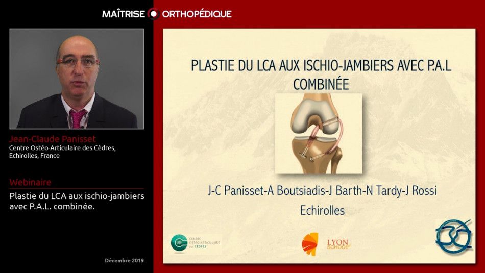 Plastie du LCA aux ischio-jambiers avec P.A.L. combinée