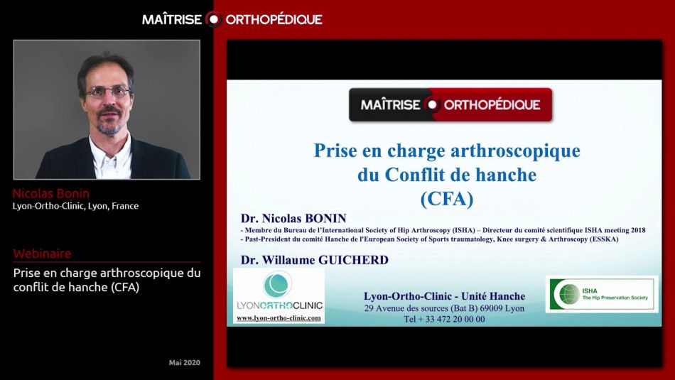 Prise en charge arthroscopique du conflit de hanche (CFA)